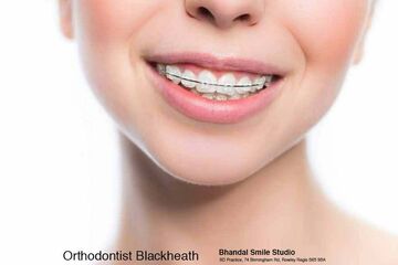 Orthodontist blackheath west midlands